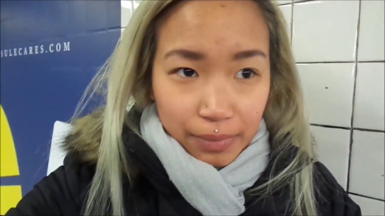 Philtrum Day 10- Final Bar Change