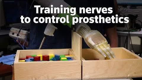 Scientists boost brain signals to control prosthetics