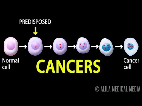 Cancer, How Cancer Starts, How Cancer Spreads, Where and Why, Animation.
