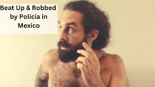 I Got Robbed, Beat Up, And Jailed By The Police In Tulum Mexico