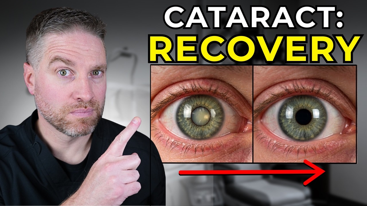 Cataract Surgery Recovery: What to Expect After Surgery! - YouTube