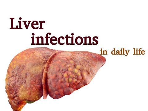 Reasons of Fatty liver