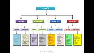 Uveitis Made Easy by Prof Dr Hussain Ahmad Khaqan