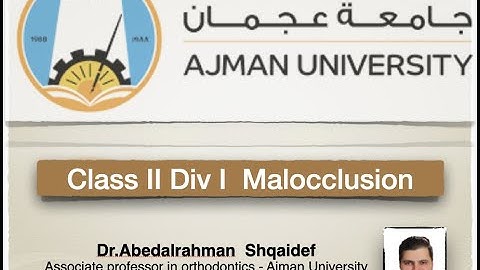Class II div I maloclusion