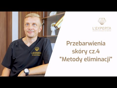 Przebarwienia skóry -