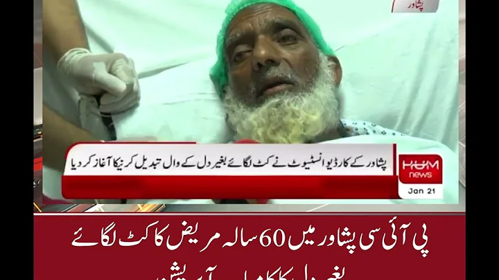 Successful heart operation without implantation of 60 year old patient in PIC Peshawar