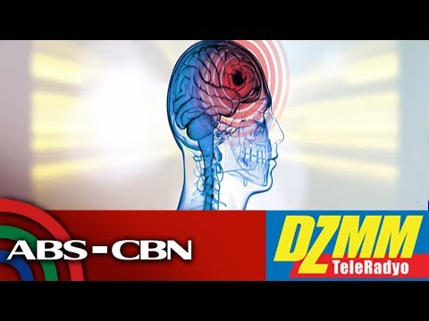 Video: 11 Mga paraan upang Magamot ang isang Migraine