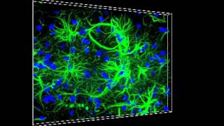 ZEISS ApoTome.2 - Rat Hippocampus Optical Sectioning