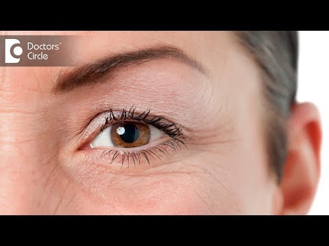 Video: Zijn scheelziende ogen erfelijk?