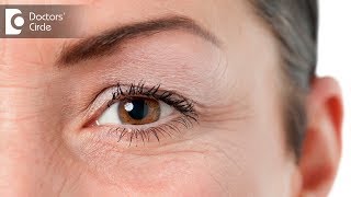 Are eye conditions hereditary? - Dr. Anupama Kumar