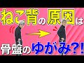 【猫背の原因】病院では治せない！ねこ背の本当の原因は、骨盤のゆがみ？！エゴスキュー体操【公式】