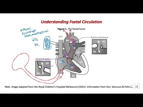 Video: Wat zijn pre- en post-ductale zuurstofverzadigingen?