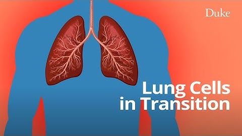 Lung Stem Cells in Transition: A Culprit in Lung Fibrosis