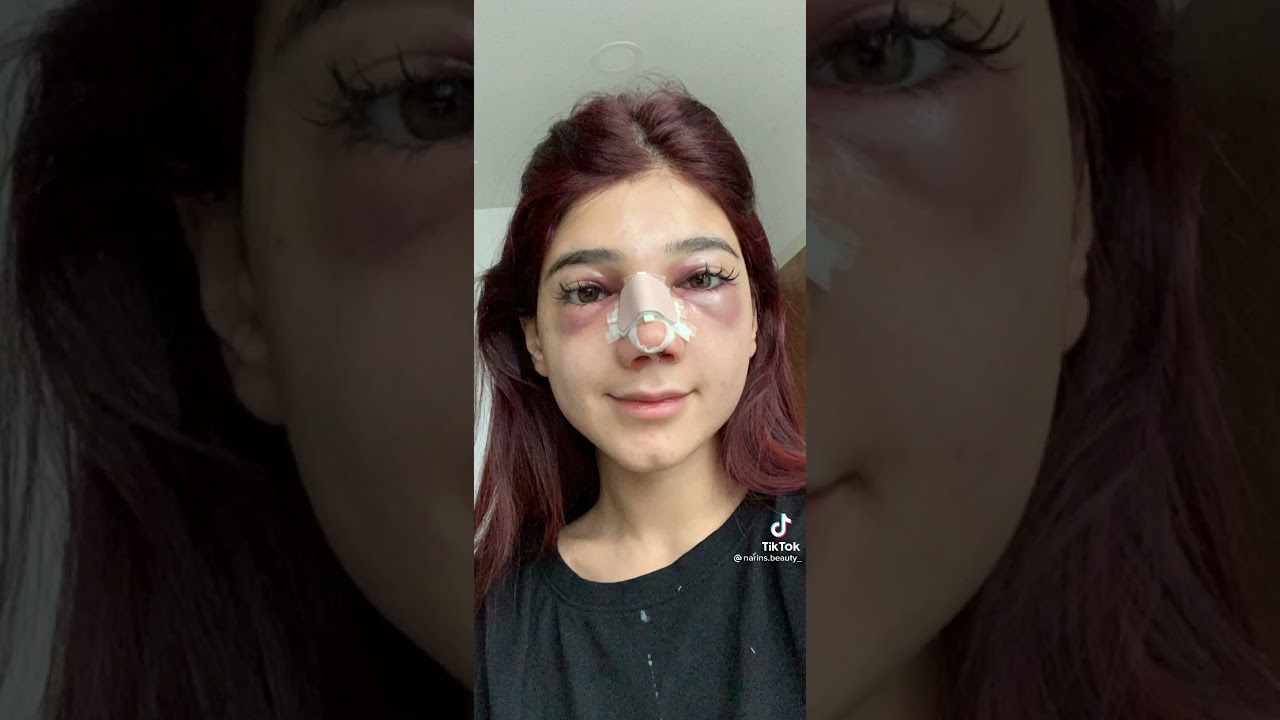 Watch تيك توك narins beauty جديدة #shorts on YouTube Watch تيك توك narins beauty جديدة #shorts on YouTube