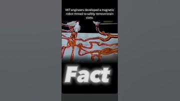 MIT’s Magnetic Robot Thread That Removes Brain Clots 🧠 | Future of Surgery.