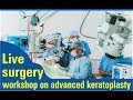 Live surgery workshop on advanced keratoplasty