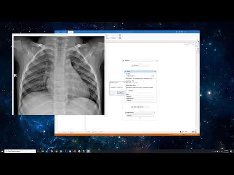 Detecting COVID - 19 cases with #RPA, #AI and Machine Learning - UiPath