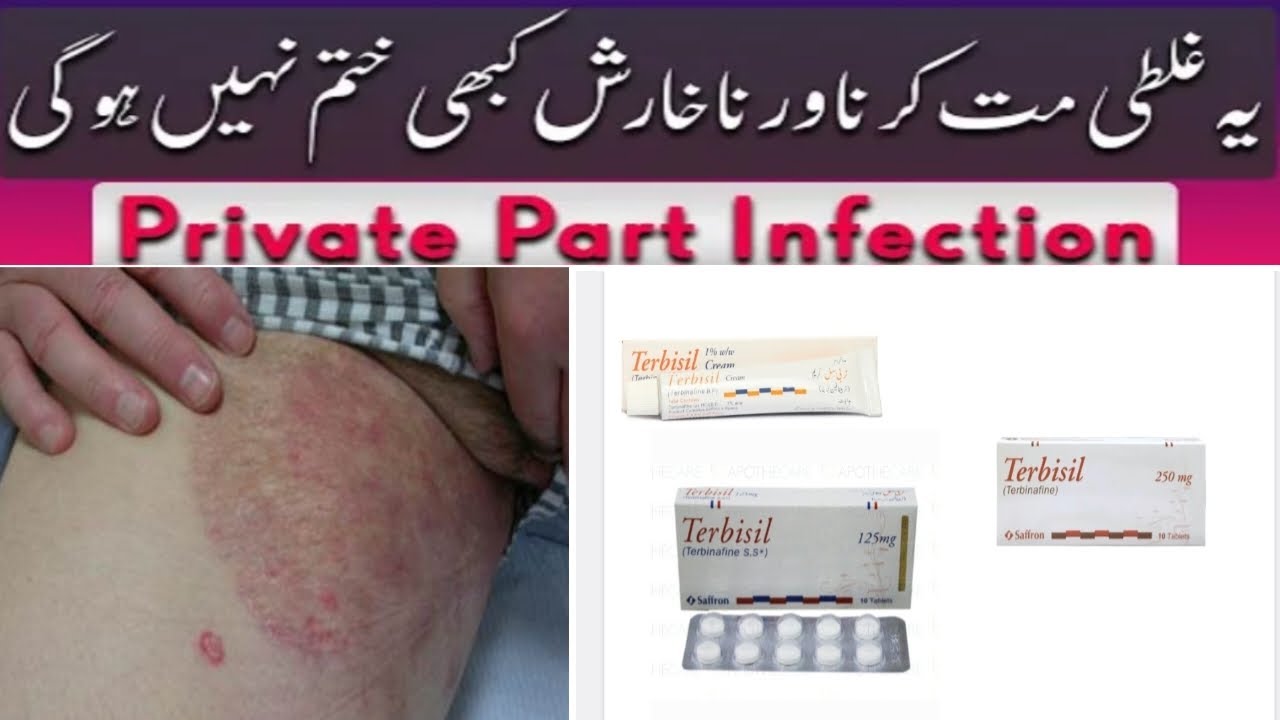 Terbisil cream and Tablet jocks_itch private_part_infection terbisil