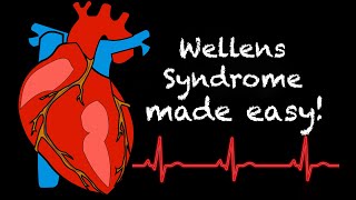 EMS Cardiology || Tachy Tuesday: Wellens Syndrome in EMS