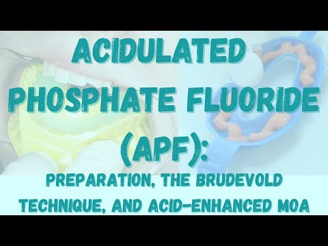Apf Guide APF of HCP: Acidulated Phosphate Fluoride (Clinical Guide) - GetAcademy ...