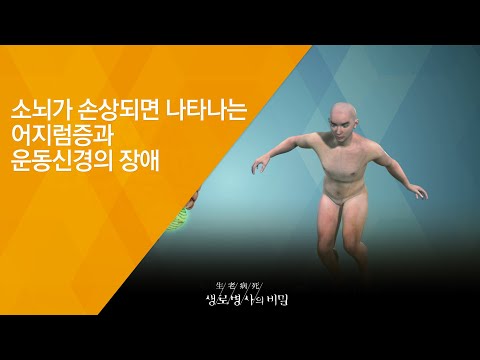 Dizziness and Motor Nerve Impairment from Cerebellar Damage - (Broadcast on 6/27/2018, Episode 65...