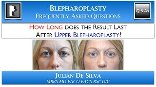 HOW LONG does the result last after Upper Blepharoplasty? How many YEARS does an eyelid lift last?