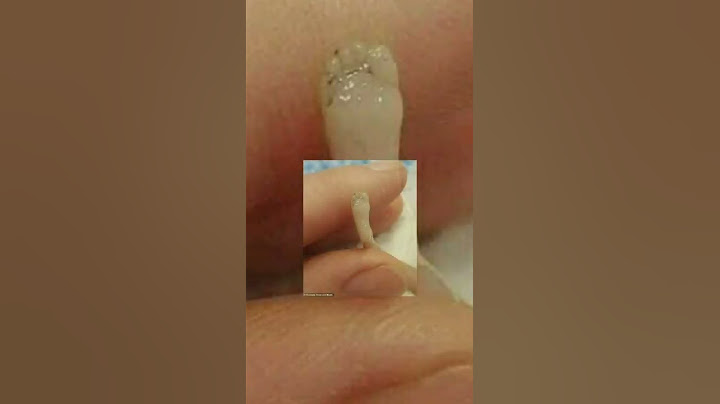 رفضت الام عملية الاجهاض و جت رسالة أن الجنين يكون مكتملا رغم صغر حجمه ووزنه