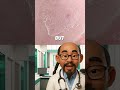 WHY You Keep Getting Pimples