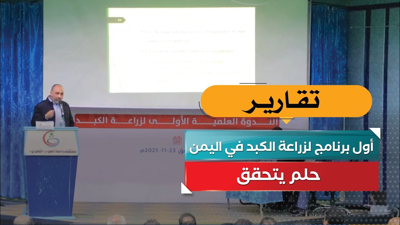 أول برنامج لزراعة الكبد في اليمن… حلم يتحقق!