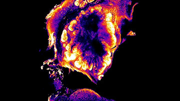 Visikol HISTO - Mammary Tissue - Ki67