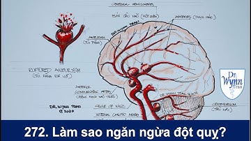 #272. Làm sao ngăn ngừa đột quỵ? Đột quỵ do vỡ túi phình - Stroke and brain aneurysm