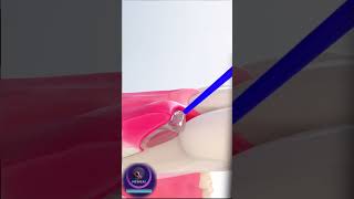 How Topical Dental Gel Heals Inflamed Gums & Bleeding 🪥✨