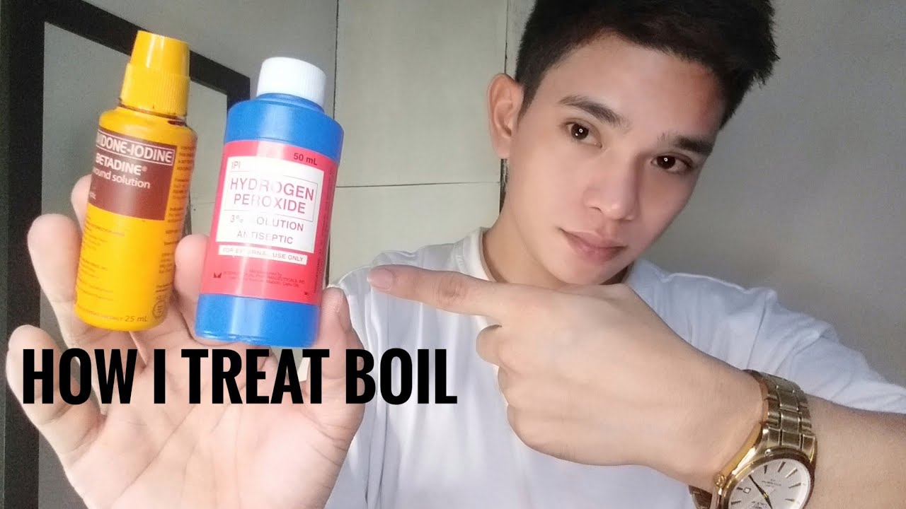 HOW TO TREAT BOIL (HOME REMEDY) | GAMOT SA PIGSA | RHENHART LOSARIA