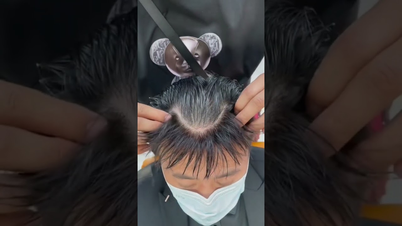 Pola rambut berbentuk M