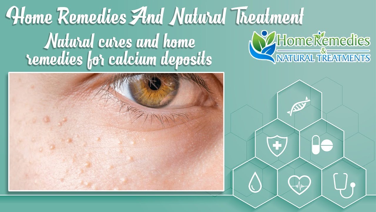 Calcium deposit removal home remedy YouTube