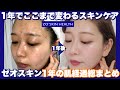 【肌悩み全て解決】ゼオスキン1年間使用経過総まとめ!【シミ/色素沈着/シワ/肝斑が改善する透明感があがるスキンケア】by桃桃