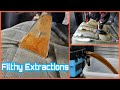 Simply EXTRACTIONS | FILTHY Deep Cleaning Compilation Ep1