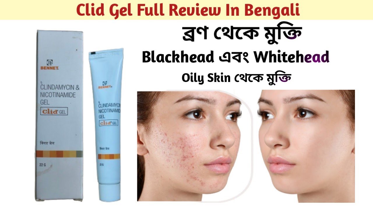 Clid Gel Uses In Bengali । Acne Problem Solution । Clindamycin & Nicotinamide Gel ।
