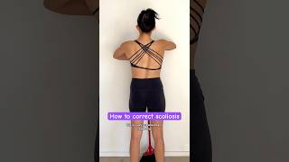 How to correct scoliosis #scoliosistreatment #scoliosiswarrior