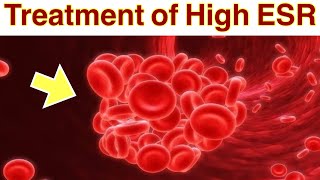Natural Treatment of high ESR | How to reduce high ESR Levels Naturally | Remedies for Lowering ESR
