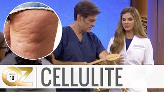 3 At-Home Cellulite Treatments