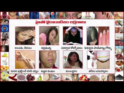 ఆహార ఆరోగ్య విద్య – థైరాయిడ్ రుగ్మతలు (Aahaara Aarogya vidya  Thyroid rugmatalu)