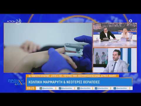 Τι είναι η Μερική Ανάληψη και Πώς Λειτουργεί;