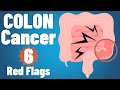 Colon cancer: 6 EARLY symptoms & why they occur | Colon cancer symptoms | colorectal cancer