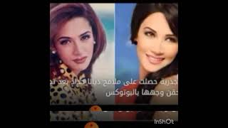 #فنانات _قبل #وبعد _عمليات #التجميل # Before and after cosmetics