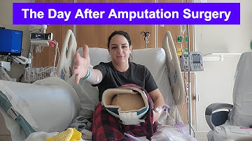 Below the Knee Amputation: What It’s Really Like the First Day after Amputation