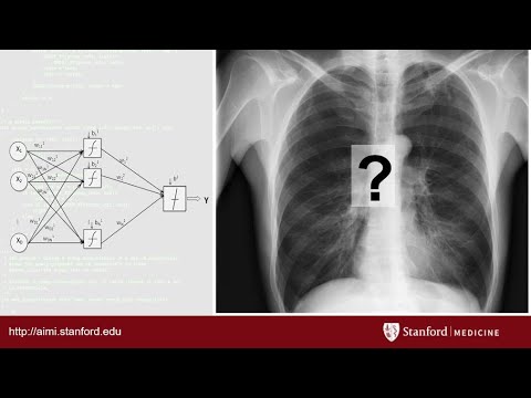 AI in Radiology at Stanford: Rise of the Machines