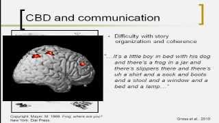 Overview of Corticobasal Degeneration and Progressive Supranuclear Palsy