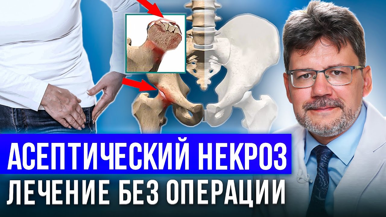 Асептический некроз головки бедренной кости -как диагностировать, как лечить консервативным способом