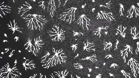 Pattern formation in slime mold Dictyostelium